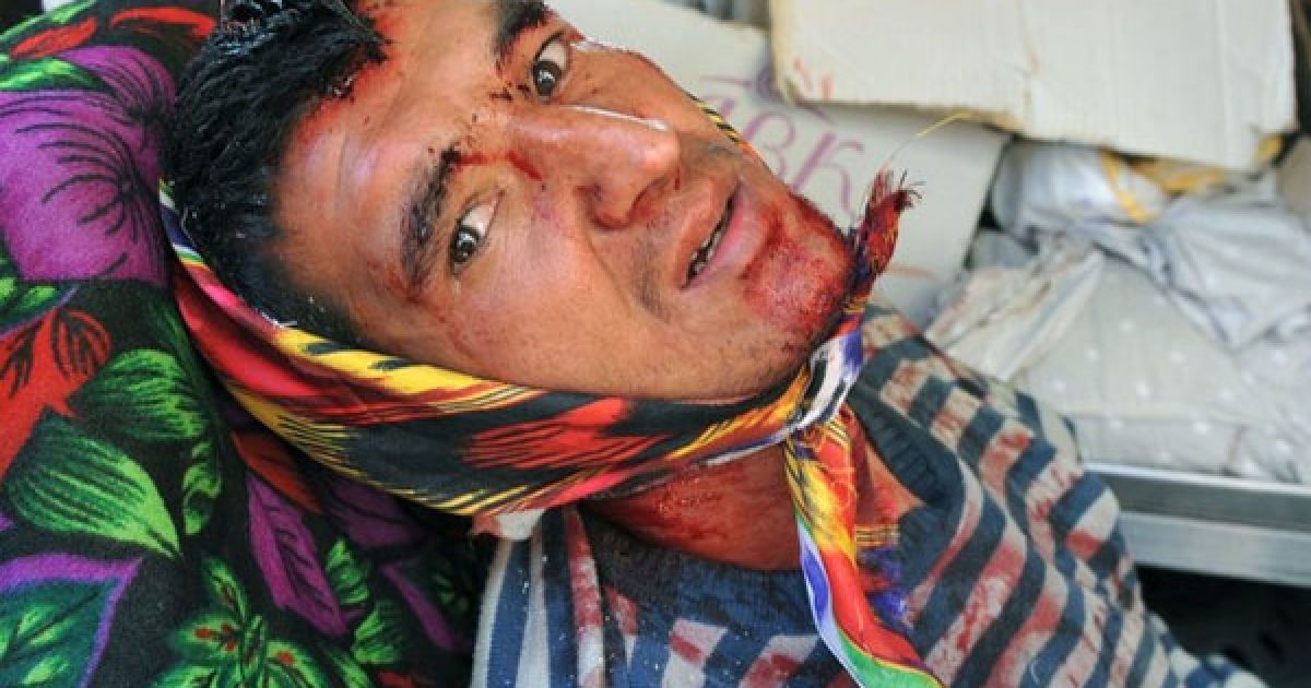 Кількість загиблих в результаті міжетнічних заворушень на півдні Киргизії зросла до 104 людей, більше 1200 постраждали / © Getty Images/Fotobank