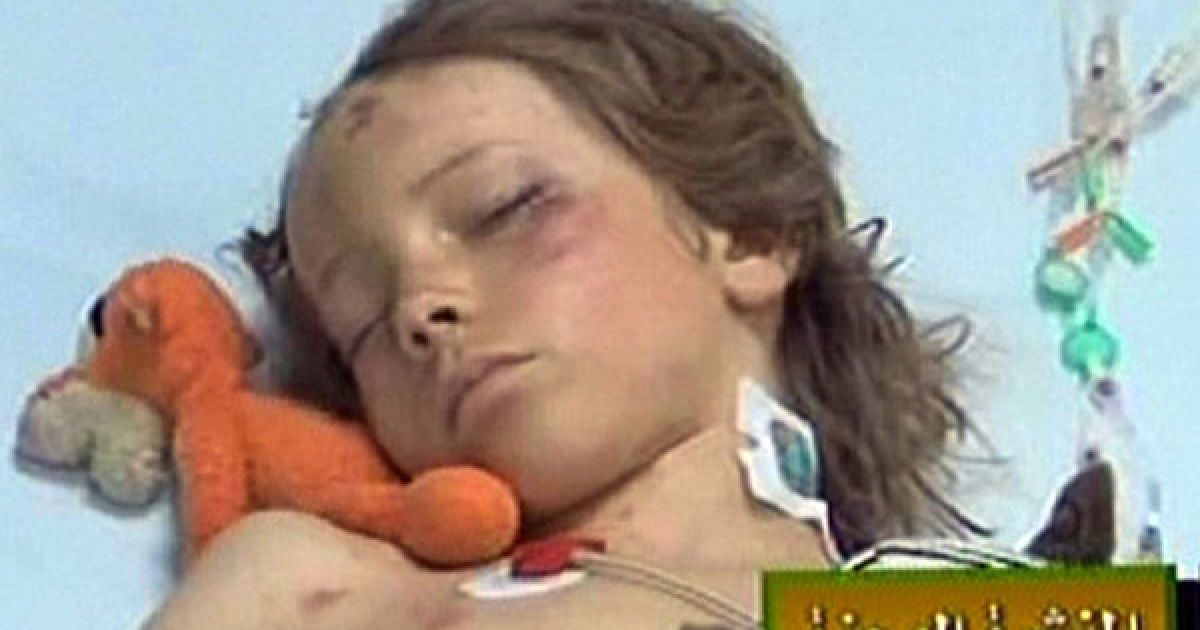Лівійська Арабська Джамагирія, Тріполі. 9-річний хлопчик з Нідерландів &mdash; єдиний, хто вижив у авіакатастрофі Airbus A330 Afriqiyah Airways, що сталася у міжнародному аеропорту Тріполі. У авіакатастрофі загинули 103 людини. Син лівійського лідера провідав хлопчика у лікарні. / © AFP