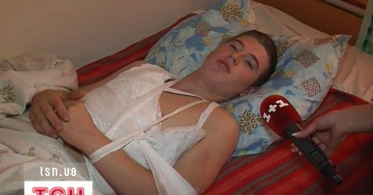 Четверо юнаків з тяжкими травмами перебувають у лікарні