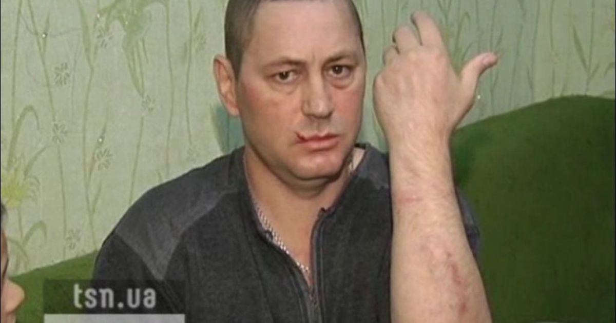 Після обшуку інваліда спішно забрали на обстеження до нейрохірургії