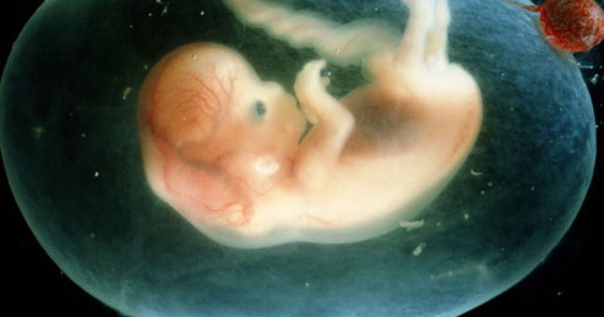 В Японії батькам пропонують копію ембріона своєї дитини.