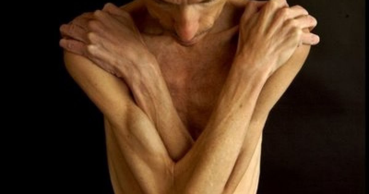 Серед чоловіків стало "модним" хворіти на анорексію / © Перший національний