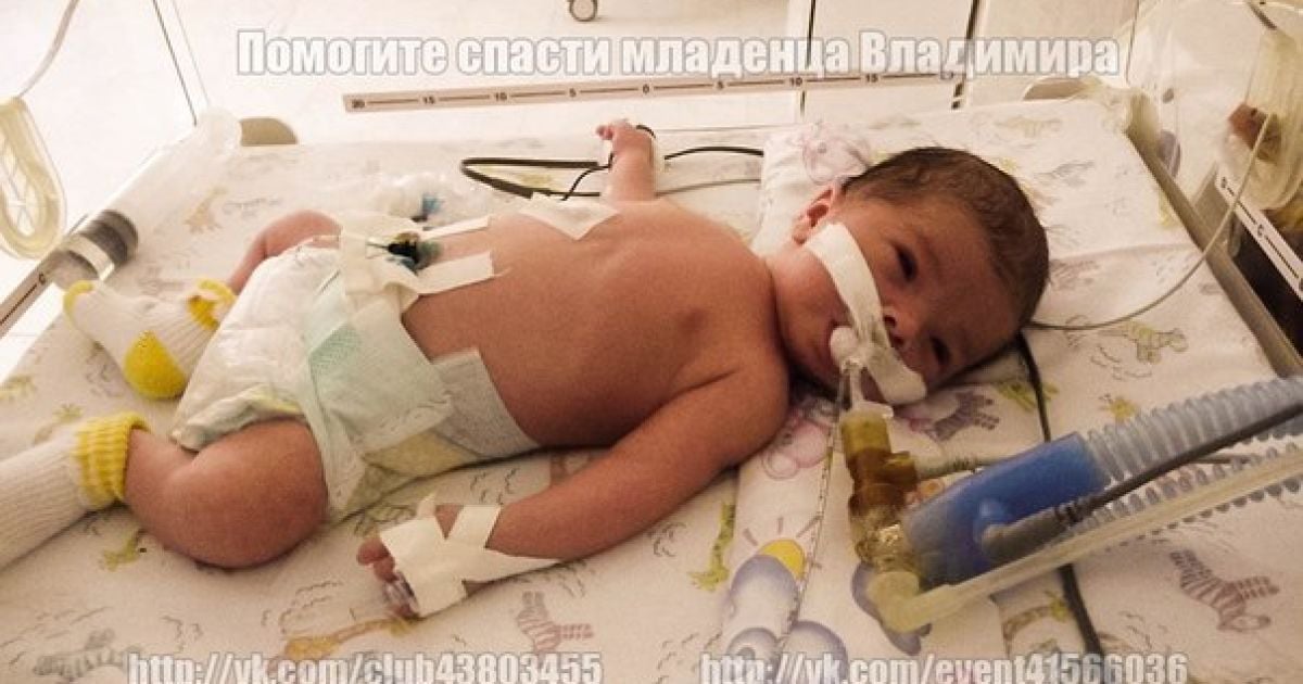 Маленький Вова страждає на псевдобульбарний синдром і епілепсію