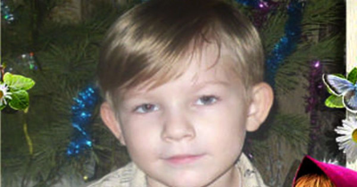 Хлопчик у вкрай важкому стані з численними опіками