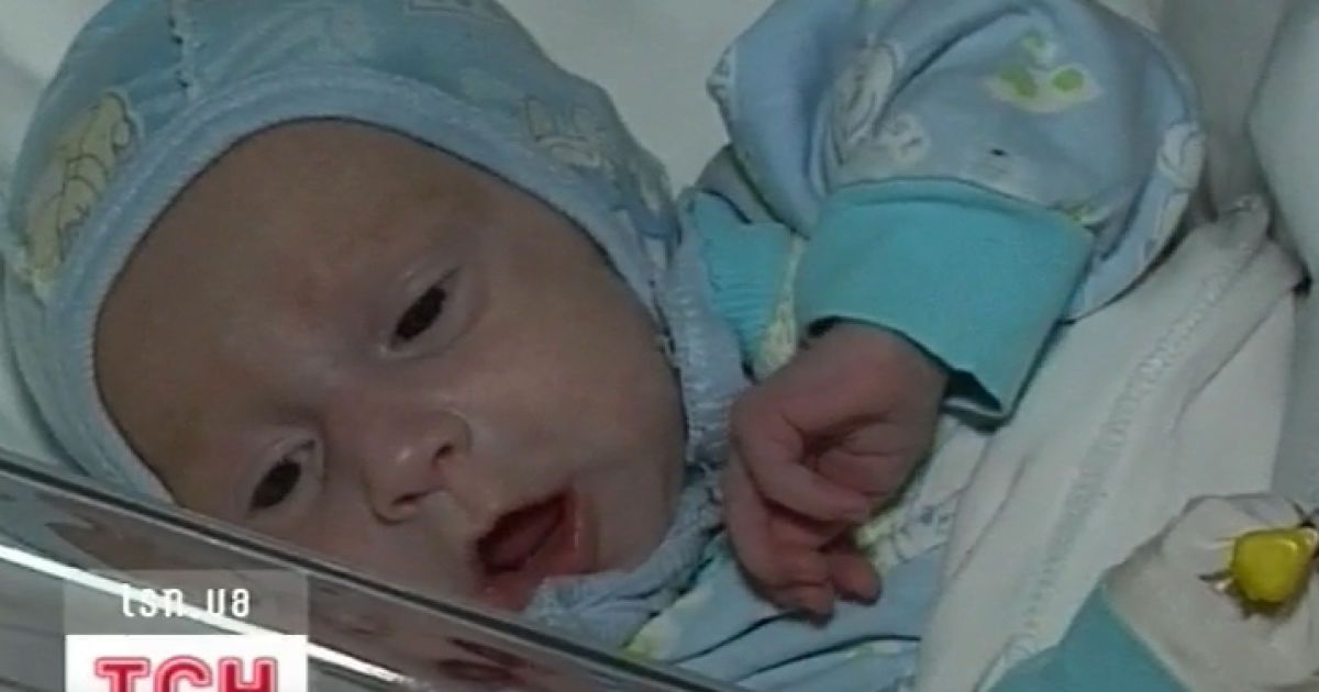 Лікування та реабілітація дітей будуть тривалими