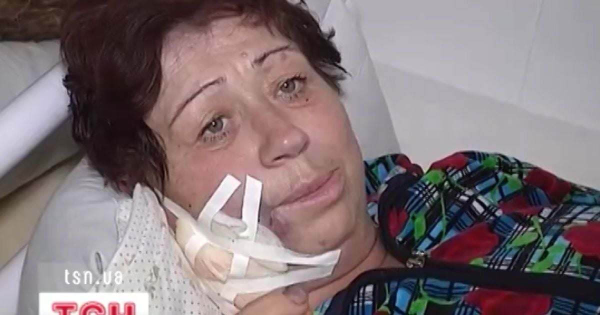 Життя жінки ледве врятували судинні хірурги