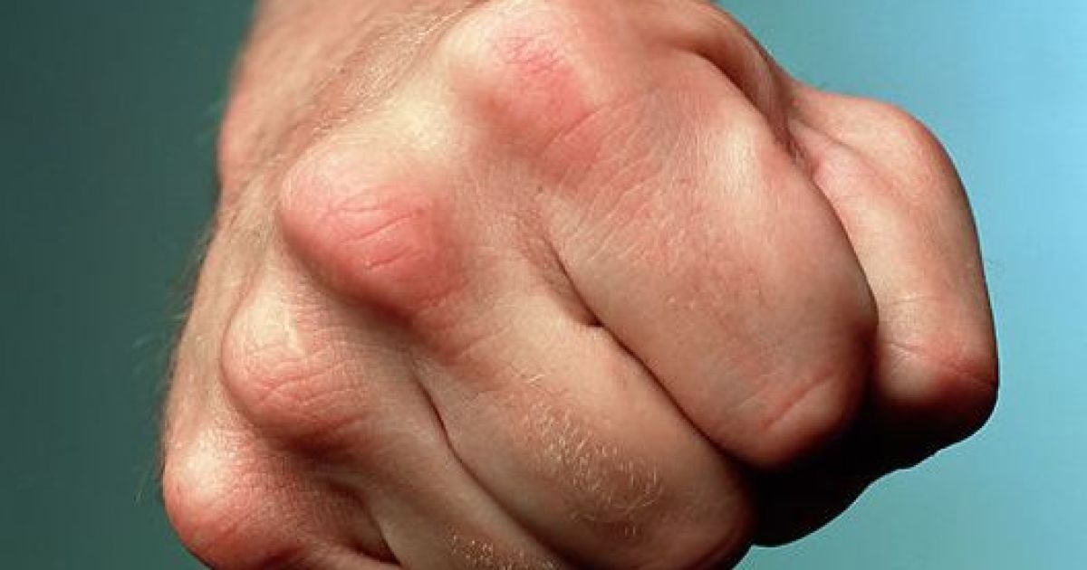 Молодик двічі побив правоохоронця