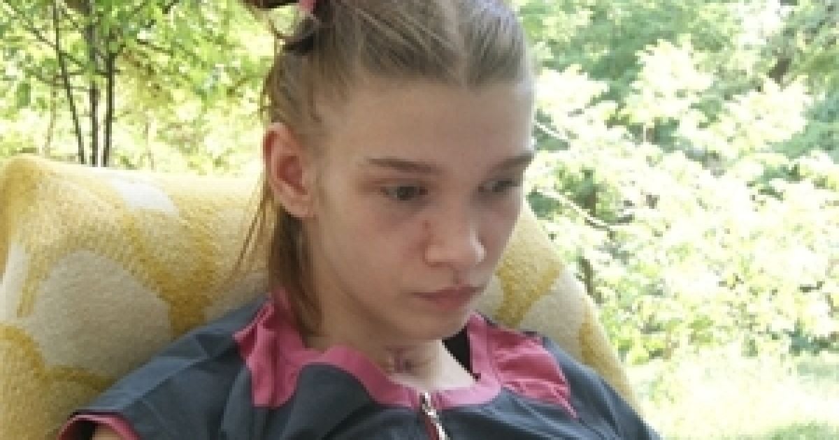 Міліціонери перевірять, чи могли дівчата зупинити побиття Саші