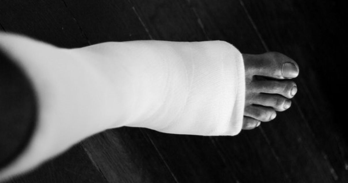 У Маямі на пляжі знайшли відрізану взуту ногу