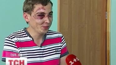 На Хрещатику жорстоко побили голландського вболівальника