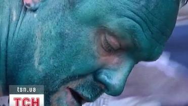 Захисника Тимошенко Сергія Власенка облили зеленкою