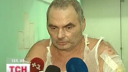 На Донеччині одужує чоловік, який фактично не мав шансів на життя