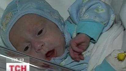 У закарпатському Мукачевому медики рятують життя півторамісячним двійняткам