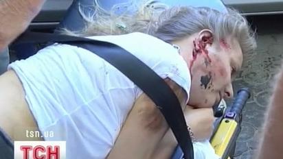 В Одесі на тротуарі водій спортивної "Мазди" збив жінку