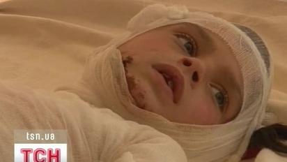 Дитячі ігри призвели до трагедії