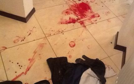 У Москві труп дівчинки знайшли в холодильнику, а сестру побили до гематом