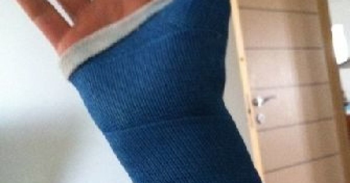 Павлу Воля в драке сломали руку