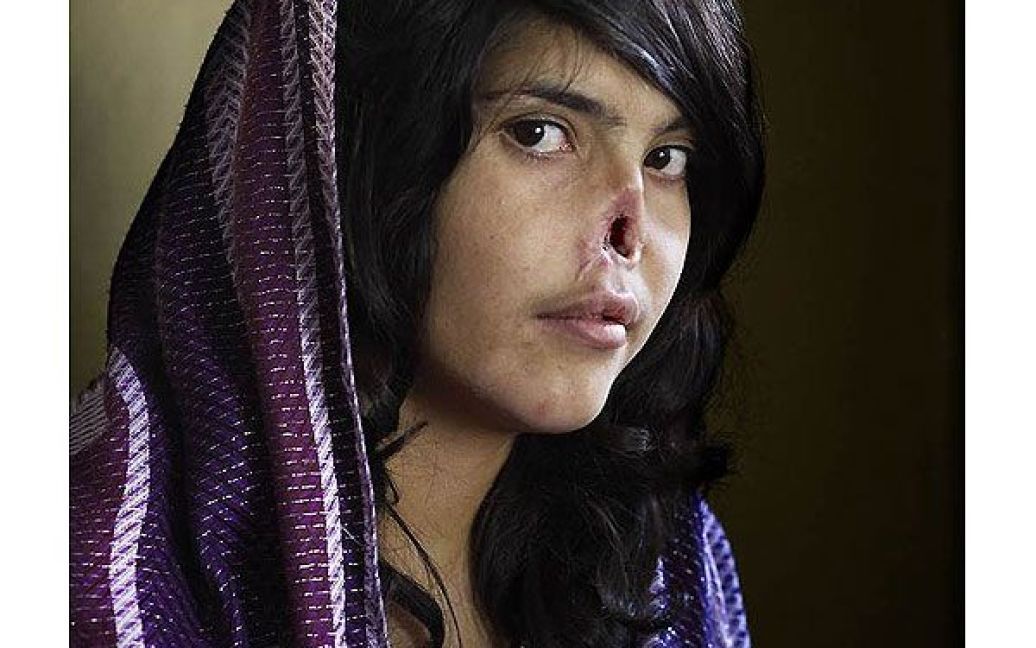 Фотографією року назвали роботу фотографа з ПАР Джоді Бібер. Це портрет 18-річної дівчини Бібі Аїші з провінції Орузган (Афганістан), що втекла від чоловіка в будинок своїх батьків, після того, як чоловік почав бити її. До батьків приїхали таліби, вимагаючи видати Бібі, після чого її чоловік відрізав їй вуха і ніс. Бібі кинули помирати, але її врятували гуманітарні працівники і американські військові. (Jodi Bieber / Institute for Artist Management for Time magazine) / © Worldpressphoto