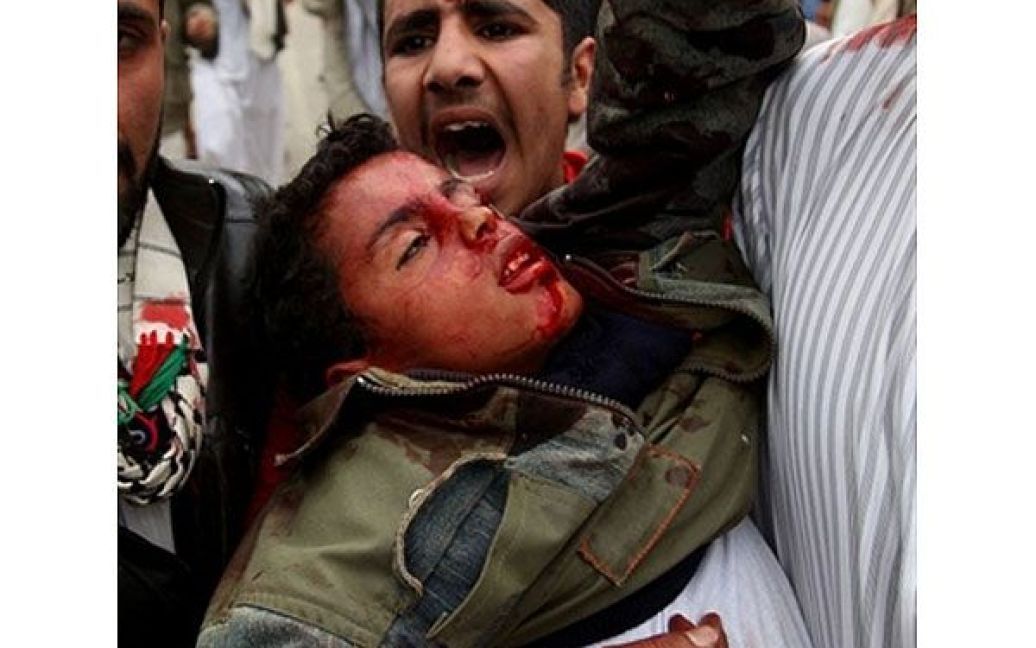 Ємен, Сана. Єменські антиурядові демонстранти допомагають пораненим під час акції протесту в Сані, коли більше 30 антиурядових демонстрантів були вбиті, більше 100 отримали поранення. / © AFP