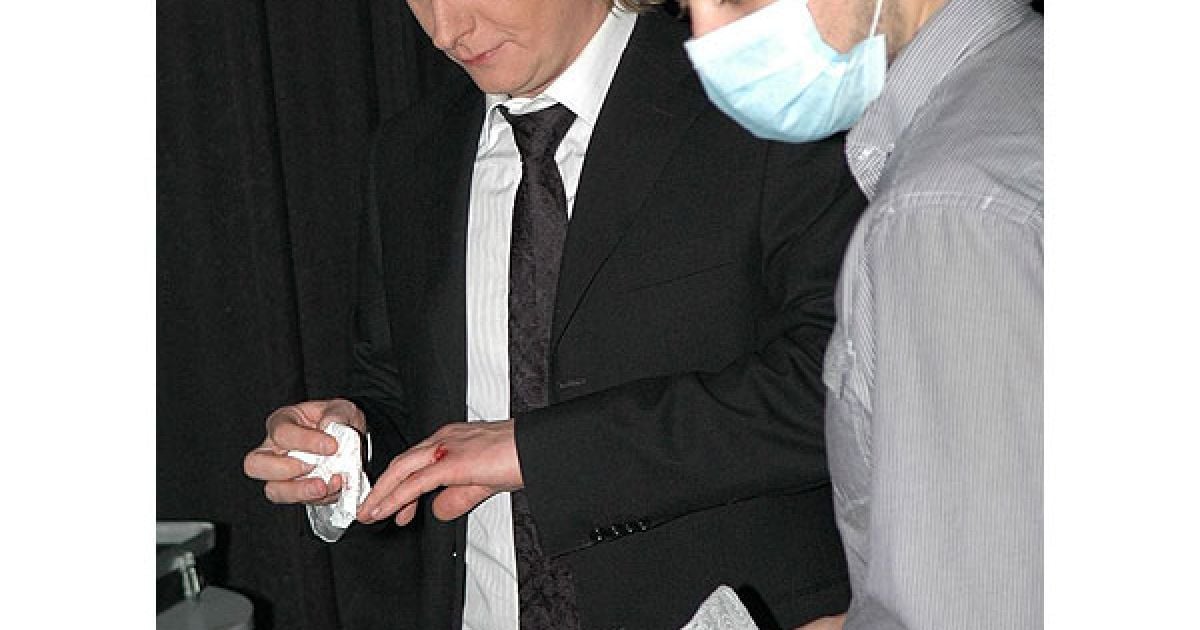 Степан Казанін на сцені поранив руку. Кров не могли зупинити дуже довго.