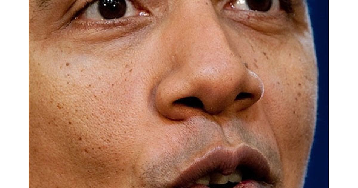 США, Вашингтон. Президент США Барак Обама розповідає про пропозицію щодо заморожування урядових зарплат на два роки під час
прес-конференції у Білому домі у Вашингтоні. Обама також розповів про
травму нижньої губи, яку він отримав під час гри у баскетбол, після
чого йому наклали 12 швів. / © AFP