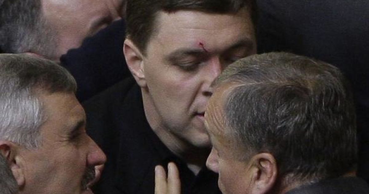 Податковий кодекс потрапив у голову депутату від БЮТ Олександру Дубовому та розсік йому брову. / © УНІАН