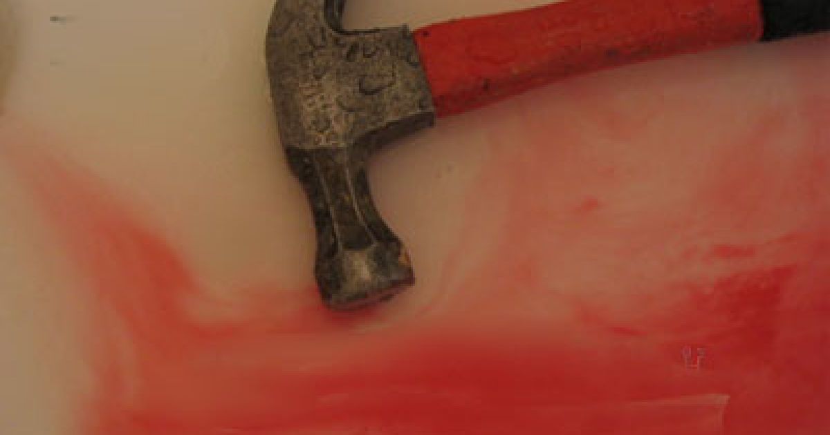 Хлопець убив своїх батьків молотком. Ілюстрація