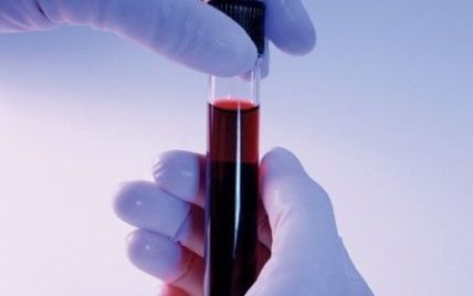 Вперше в світі пацієнтові перелили штучну кров