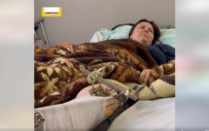 Пересадили тканини зі спини на кінцівку, аби врятувати ногу: львівські лікарі прооперували жительку Бахмута