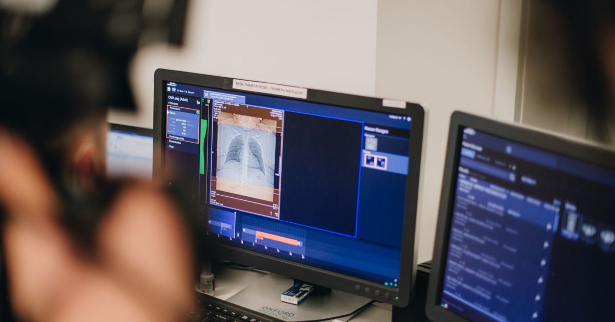 "Зіркові легені"