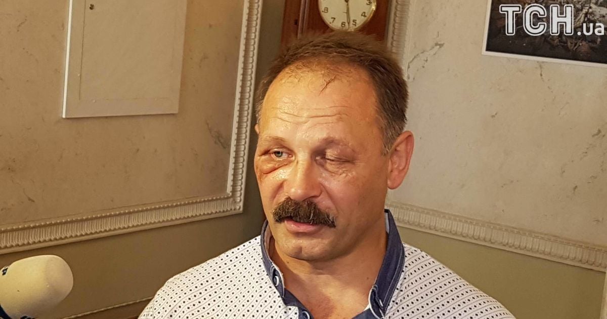 Нардеп Барна порівняв із шакалами мітингувальників, які його побили