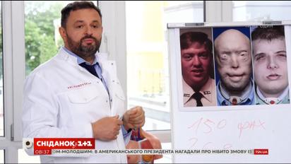 Як здійснюється повна пересадка обличчя