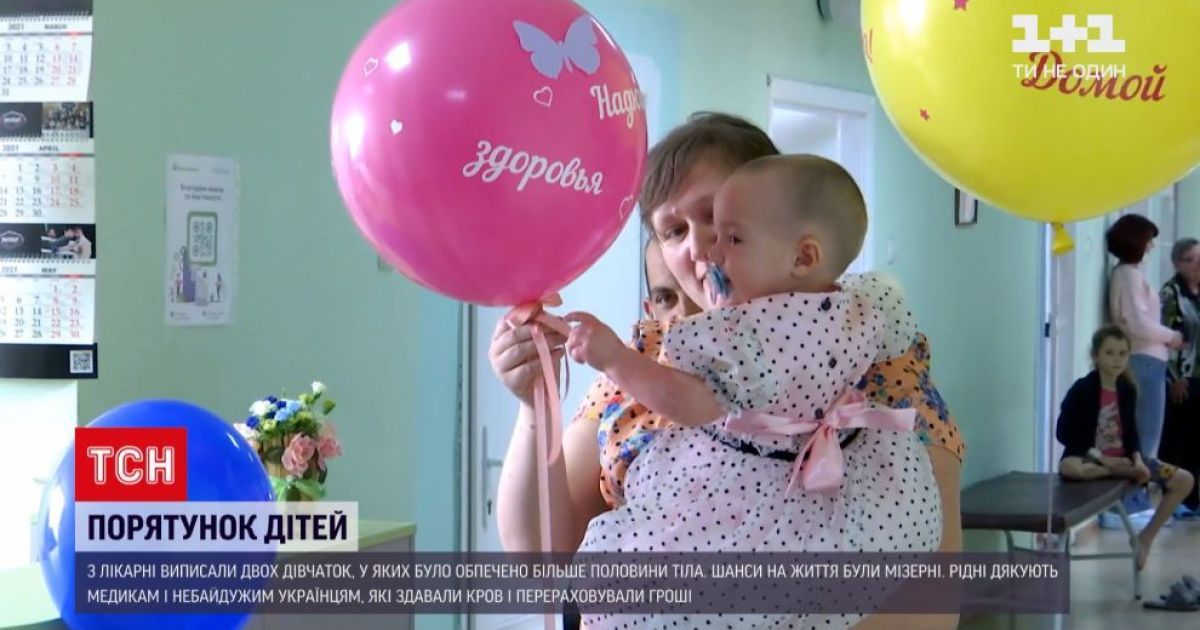 Шансы на жизнь были мизерными: из больницы Днепра выписали девочек, которые имели ожоги более половины тела