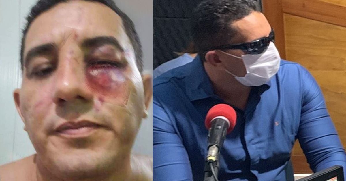 В Бразилии мэр города устроил бой по правилам UFC со своим бывшим советником: видео эпической "зарубы"