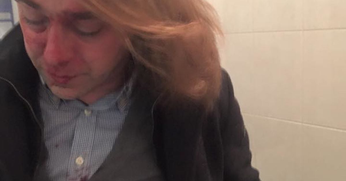 Мірошниченко стверджує, що його побили / © Facebook/Ігор Мірошниченко