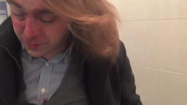 Мірошниченко стверджує, що його побили / © Facebook/Ігор Мірошниченко