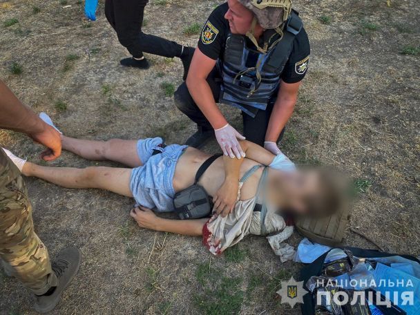 Поранена дитина на Запоріжжі / © Національна поліція України