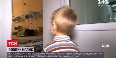 В Одесі мати побила дворічного сина на дитячому майданчику