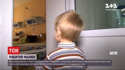 В Одесі мати побила дворічного сина на дитячому майданчику
