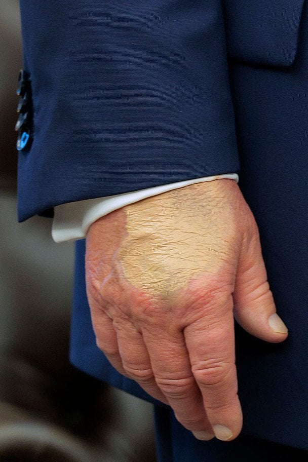 Рука Дональда Трампа з макіяжем  / © Getty Images