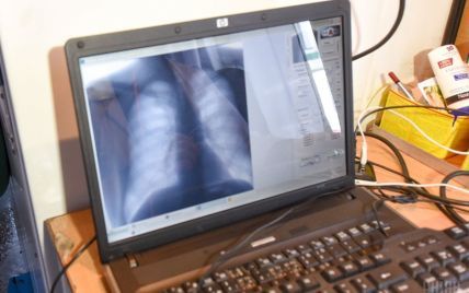 Що робити пацієнтам з туберкульозом у Києві: поради