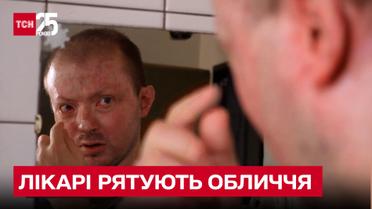 Вертають скалічені війною обличчя - американські хірурги вчать українських колег