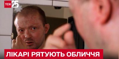 Вертають скалічені війною обличчя - американські хірурги вчать українських колег
