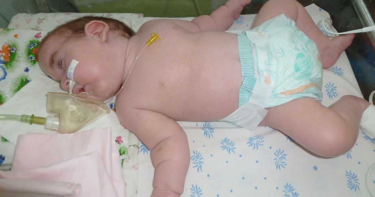 Помогите в лечении 1-летнего Богданчика