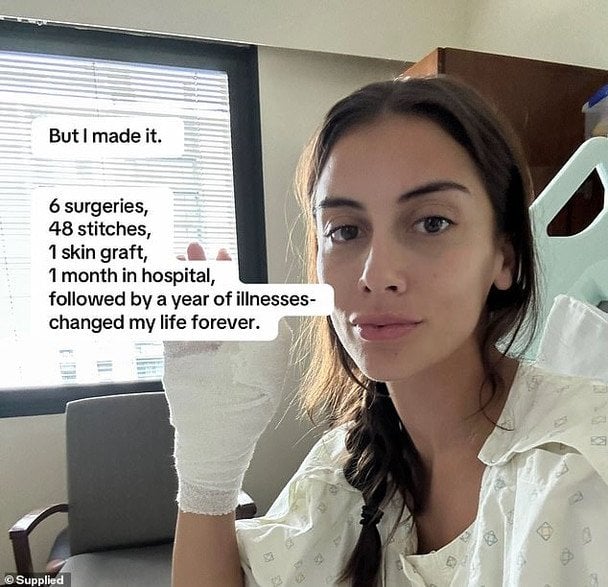 Клаудії Руффін ампутували палець після походу на манікюр / © Фото, надане Клаудією Руффін