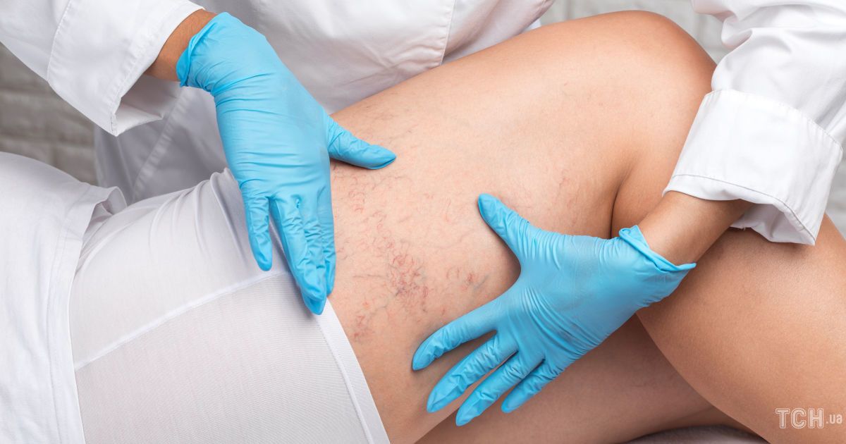 Топ-3 продуктов для здоровья ваших сосудов