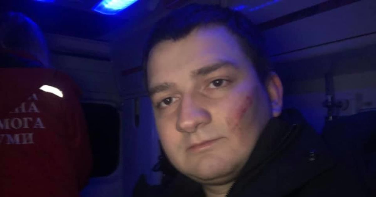 Нардеп от "Слуги народа" заявил об избиении в Сумах