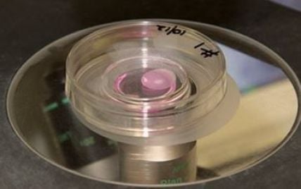Австралийские ученые создали мини-копии человеческих почек