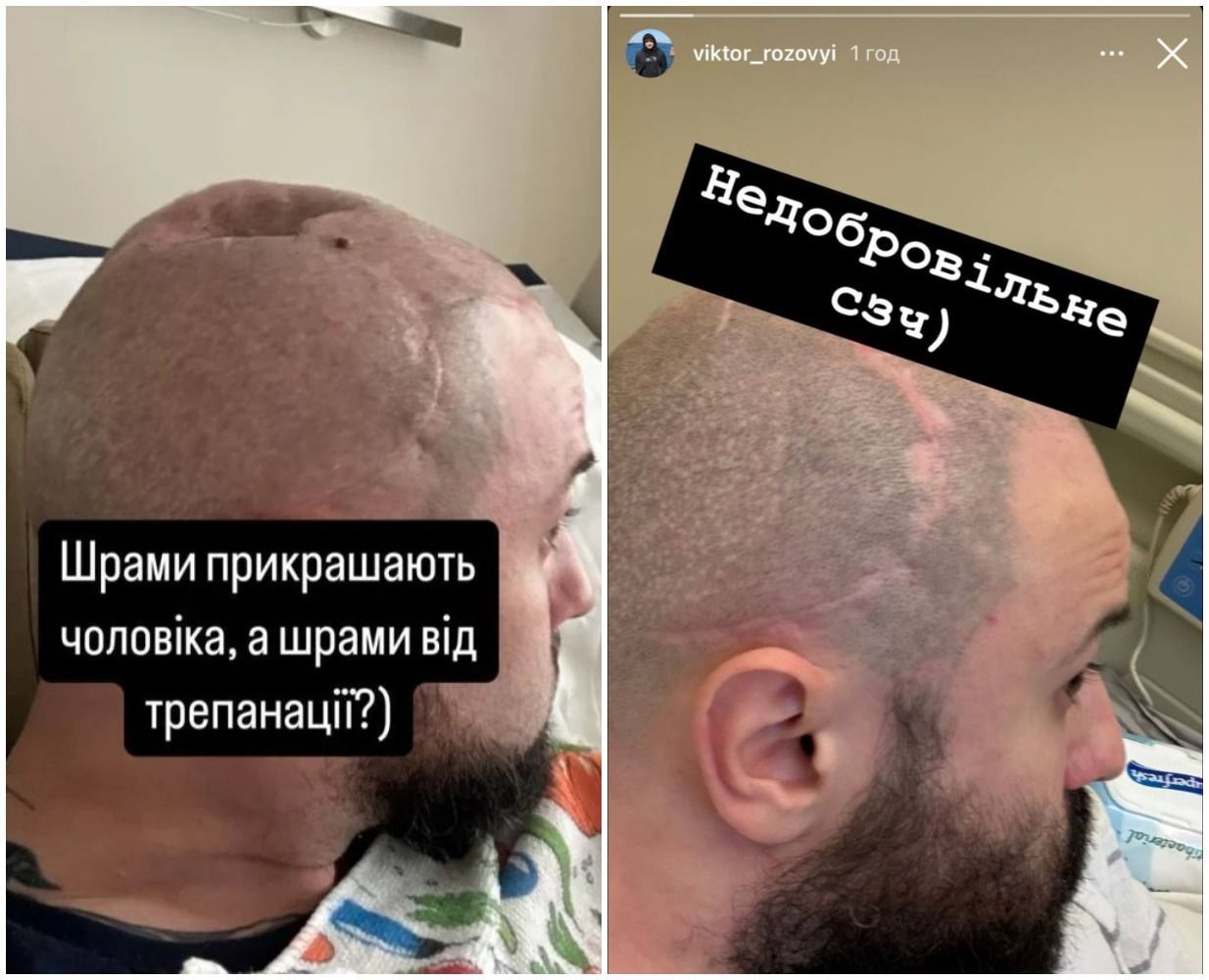 Виктор Розовый показал изменения во время продолжительной реабилитации / © instagram.com/viktor.rozoviy