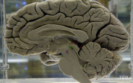 С днем мозга всех причастных: интересные факты о главном человеческом органе и поздравительные головоломки
